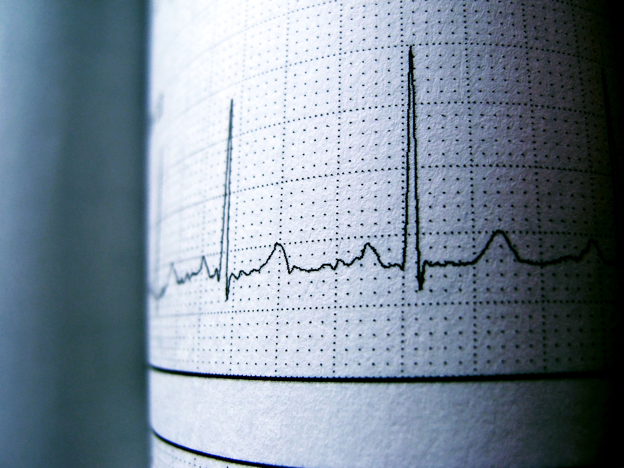 IN THE NEWS: CENTRALIZED CARDIAC TELEMETRY MONITORING SLASHES ALARM FATIGUE, SAVES LIVES!